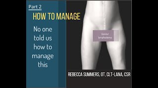 Genital lymphedema women part 2  How to Manage [upl. by Sirtimid]