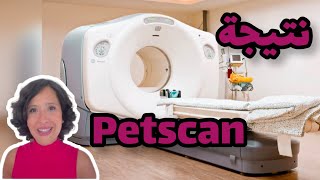 نتيجة موعد المراقبة السنوي ديالي من بعد ايصابتي بالسرطان petscan [upl. by Bust257]