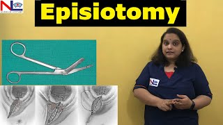 Episiotomy  Perineotomy  Nursing Lecture [upl. by Gnouhp240]