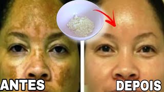 CLAREIA TUDO MELASMA AXILA ACNE VIRILHA  COM 2 INGREDIENTES [upl. by Asil]