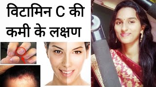 विटामिन सी C की कमी के 10 प्रमुख लक्षण  Symptoms of Vitamin C deficiency [upl. by Voss564]