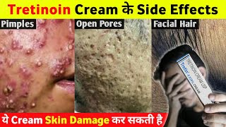 Tretinoin Cream के ये Side Effects आप नहीं जानते होगे 😱 [upl. by Godfree981]