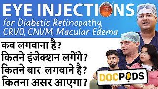 Eye Injections for Retina Treatments Explained  DocPods  Episode 1 [upl. by Okun]