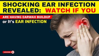 Shocking Ear Infection Revealed Watch If You Are Having Earwax Buildup or It’s an EAR INFECTION [upl. by Ruhl]