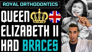 QUEEN ELIZABETH II and her ORTHODONTIC treatment Did you know she had BRACES [upl. by Ilrebmyk]