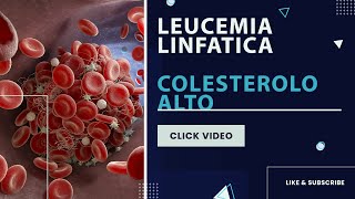 Leucemia linfatica cronica  Colesterolo alto [upl. by Undine]