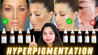 💯 Top Ordinary Skincare For Hyperpigmentation and How to Use Them [upl. by Atoked]