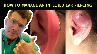 How to recognise manage and treat an infected ear piercing  Doctor ODonovan explains [upl. by Natelson]