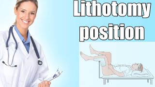 Lithotomy position indications  Physiological effects  Hazards [upl. by Batha]