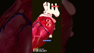 Coronary Arteries in the Surface of Heart Muscles fitmyheartnow [upl. by Eugeniusz601]