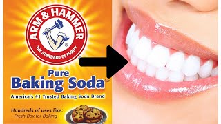 Can Baking Soda ACTUALLY Whiten Teeth [upl. by Reiko]