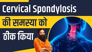 Cervical Spondylosis की समस्या को ठीक किया  Swami Ramdev [upl. by Graff32]