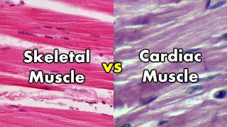 Differentiating Skeletal Muscle and Cardiac Muscle  Striations vs Intercalated Discs [upl. by Anaejer175]