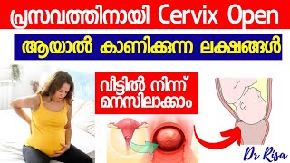 Cervix Open Symptoms Malayalam  Last Month Of Pregnancy Symptoms [upl. by Deden]