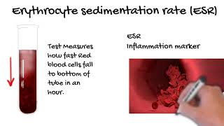 Erythrocyte Sedimentation Rate ESR what does the ESR tell you Simply Explained [upl. by Sammons]