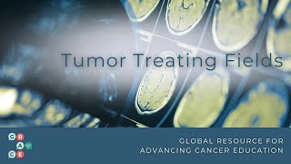 Tumor Treating Fields An Overview Mesothelioma and Glioblastoma 2024 [upl. by Samuelson547]