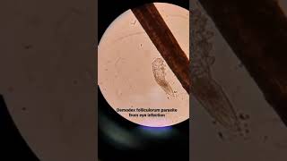 Microscopic examination of Demodex folliculorum in hair follicles [upl. by Lig173]