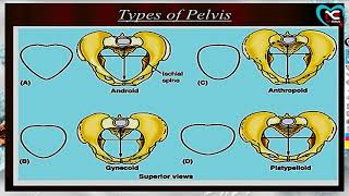 Types of Female Pelvis WITH EASY NOTES FULL EXPLANATION IN HINDI BY NG MEDICALS [upl. by Neeluj865]