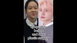 kpop idols before and after plastic surgery  part 1 🔥shorts enhypen itzy ive aespa kpopedit [upl. by Aileon]