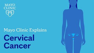 Mayo Clinic Explains Cervical Cancer [upl. by Xyla]