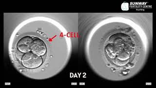 IVF timelapse imaging  Sunway Fertility Centre [upl. by Enyehc987]