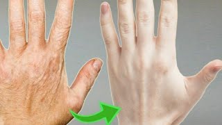 How To Make Your Hands Look 5 Years Younger Wrinkle Free Smooth Hands Dr Vivek Joshi [upl. by Lexerd802]