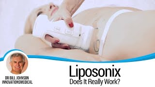 DOES IT REALLY WORK Liposonix  Non Surgical Liposuction [upl. by Tioneb521]