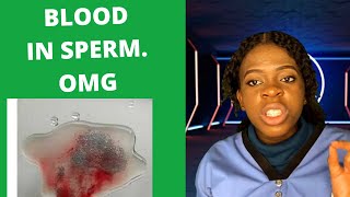 Blood in spermCauses of blood in the spermsemenHematospermia [upl. by Venita]