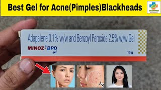 Minoz BPO Gel Use in Hindi  Minoz BPO Gel Benefits Side effects  Acne  Blackheads  SK Medicine [upl. by Valery]