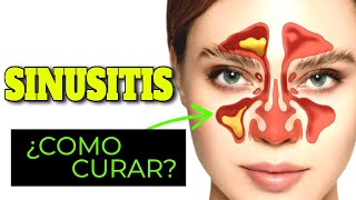 INCREIBLES TRATAMIENTOS NATURALES que CURAN la SINUSITIS [upl. by Eletnahs]