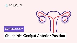 Occipito posterior delivery [upl. by Esele]