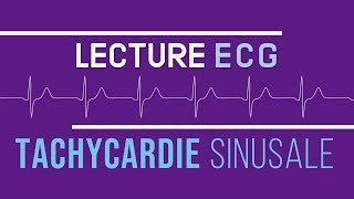 Interprétation ECG  Tachycardie Sinusale [upl. by Raye]