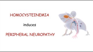 Homocysteinemia induces peripheral neuropathy [upl. by Johnna]