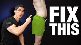 How To Fix Anterior Pelvic Tilt FOREVER [upl. by Ihsar]