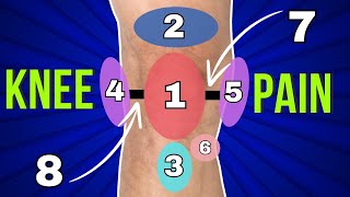 My Knee Hurts Here 10 Typical Pain Spots And What They Mean [upl. by Suoiluj990]