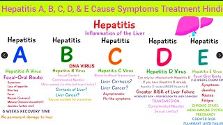 Complete Hepatitis  Hepatitis A B C D amp E Cause Symptoms Diagnosis Treatment Hindi Hepatitis [upl. by Nitsraek]