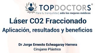 Láser CO2 fraccionado aplicación resultados y beneficios [upl. by Elleret]