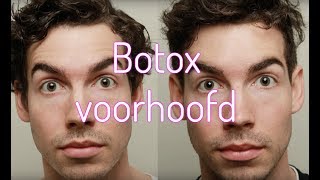 Botox voorhoofd  Furrownl [upl. by Kano]