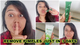 हिंदीBest Pimples removal cream  how to Remove pimples naturally at home  Boroline for pimples [upl. by Sugirdor]