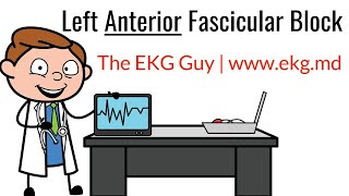 Left Anterior Fascicular Block on EKG  ECG l The EKG Guy  wwwekgmd [upl. by Odnama]