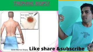 Trephine biopsy [upl. by Anuat]