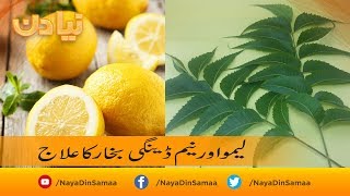 Limo aur neem se dengue bukhar ka ilaj  SAMAA TV [upl. by Theressa]