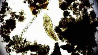 Paramecium  Pantoffeltierchen  microorganisms under a microscope  microorganism in1080p Full HD [upl. by Anrak387]