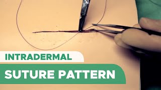 Intradermal Suture Pattern Subcuticular Suture – Intracutaneous Suture [upl. by Goldsmith]