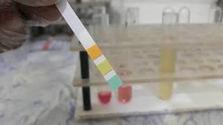 Urine Albumin Test [upl. by Rojas]