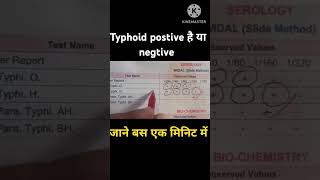 Widal test report देखे बस एक मिनिट में  widaltestreport widaltest widal typhoid typhoidfever [upl. by Idel]