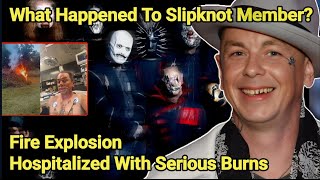 Slipknots Sid Wilson Hospitalized With Serious Burns To Face Arms  Sid Wilson  Slipknot [upl. by Ydahs520]