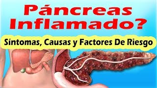 SINTOMAS DE PANCREATITIS AGUDA Y CRONICA Sintomas Del Pancreas Inflamado y Sus Causas [upl. by Sherline537]