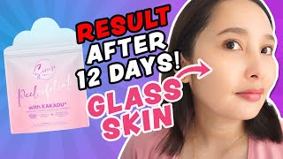 REJUV NG SEREESE BEAUTY OK BA PEEL X HONEST REVIEW [upl. by Linad]