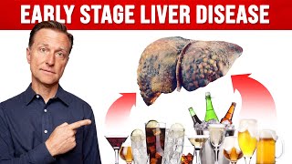 How Much Alcohol Would You Have to Drink Before Liver Damage [upl. by Esinad]